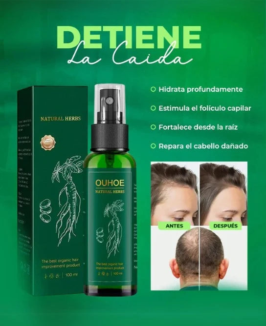 Spray Para Crecer El Pelo Ouhoe X2